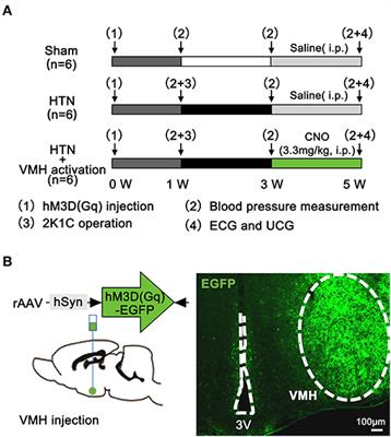 Ventromedial Hypothalamus Activation Aggravates Hypertension Myocardial Remodeling Through the Sympathetic Nervous System